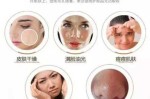 头发毛囊怎么快速去除,头发毛孔堵塞怎么清理用什么洗发水