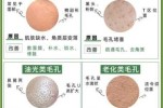 毛孔粗大什么原因（毛孔粗大怎么造成的）