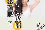怎么才能洗掉头皮屑（彻底清除头屑最快方法）
