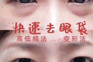 眼袋大怎么去（眼袋很严重，如何消除眼袋）