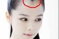 女生为什么会有美人尖（为什么有的女人有美人尖）