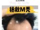 m发际线头顶头发稀少怎么剪,头发稀疏怎么治疗最有效