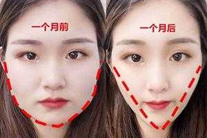 脸大要怎么变小,大脸怎么变小脸