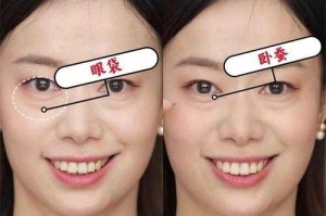 什么时候开始流行卧蚕,现在流行什么眼皮好看