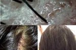 头发油了怎么办（头发油了怎么办不想洗）