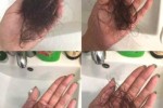 为什么发尾头发特别少,体毛重头发少为什么