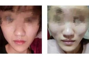 脸为什么会变大,脸怎么会变大呢
