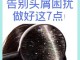 头屑多怎么办（头屑多怎么办 去除头屑）