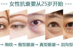 眼袋怎么形成的,眼袋是什么形成的图片
