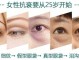 眼袋怎么形成的,眼袋是什么形成的图片