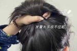 烫发后掉头发很严重怎么办,烫发后脱发怎么办女生
