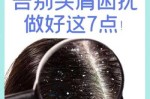 头上头屑多怎么办（头上头屑多怎么办用什么方法）