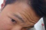 头发细软少是什么原因（额头两侧头发细而且少，中间头发厚两侧薄）