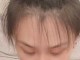 额头碎发多是什么原因（女孩子额头碎发多怎么办）