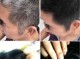 少白头怎么变黑（少白头怎么变黑发）