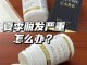 人的毛发（头发，体毛）吃进肚子里会被消化吗,毛发多吃什么药