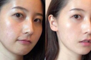 混合皮肤是什么样的（混油皮特征有哪些）