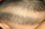 小学生适合什么发型（孩子后脑勺有一块没有头发是什么情况）