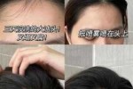 发质太硬怎么变软（发质硬，怎么把头发变软）