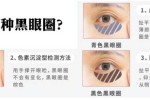 用什么去黑眼圈最有效（用什么去黑眼圈最有效的方法）
