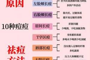 为什么会长豆豆（为什么会长痘痘有哪些原因）