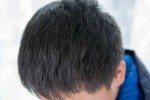 为什么少年会长白头发（为什么少年会长白头发?）