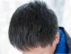 为什么少年会长白头发（为什么少年会长白头发?）