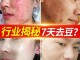 什么去黑头粉刺效果好（什么去黑头粉刺效果好一点）