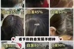 为什么白头发越来越多少年白（为什么白头发越来越多少年白）