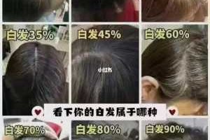 为什么白头发越来越多少年白（为什么白头发越来越多少年白）