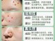 下巴毛孔堵塞怎么办（下巴毛孔堵塞怎么办小妙招）