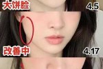 为什么体瘦的人脸宽,脸宽是为什么女生