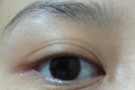 有眼纹怎么办,有眼角纹怎么办?