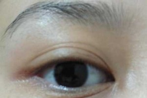 有眼纹怎么办,有眼角纹怎么办?