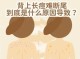 背上长痘痘是什么原因呢,为什么背上长痤疮的原因
