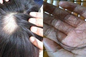 女性为什么会脱发（女性为什么会脱发严重）