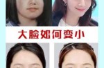 脸太大怎么办怎样变小（脸口大怎么变小）