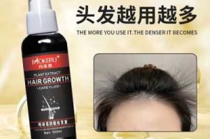 怎么才能密发（密发增发的小妙招）