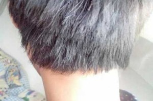 有少年白怎么办（少年白的人有什么特征）