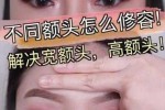 额头宽高怎么办（额头宽高怎么办才能变小）