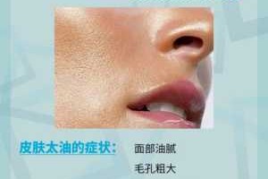夏天大油皮怎么办,夏天油性皮肤怎样护肤