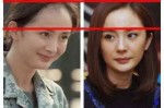 发际线为什么会后移,发际线为什么后移了