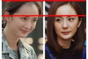 发际线为什么会后移,发际线为什么后移了