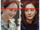 发际线为什么会后移,发际线为什么后移了