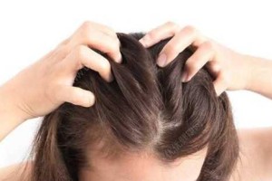 老是掉头发怎么治疗,老掉头发怎么解决女性
