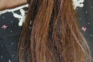为什么头发会分叉,女生头发分叉是什么意思