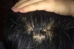 男人头发油是什么原因（男人头发油是什么原因造成的）