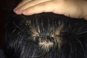 男人头发油是什么原因（男人头发油是什么原因造成的）