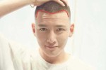 什么发际线最好看（m型发际线怎么分好看）