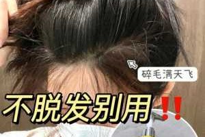 头发一洗就油怎么办,头发越洗越油怎么办小妙招